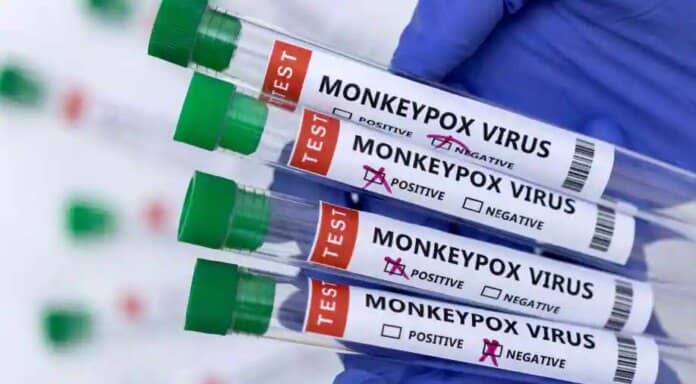 Monkeypox reaches India: First confirmed case reported in Kerala