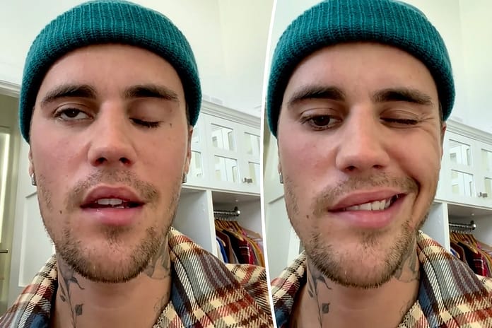 Justin Bieber’s face paralyzed after being diagnosed with rare disorder
