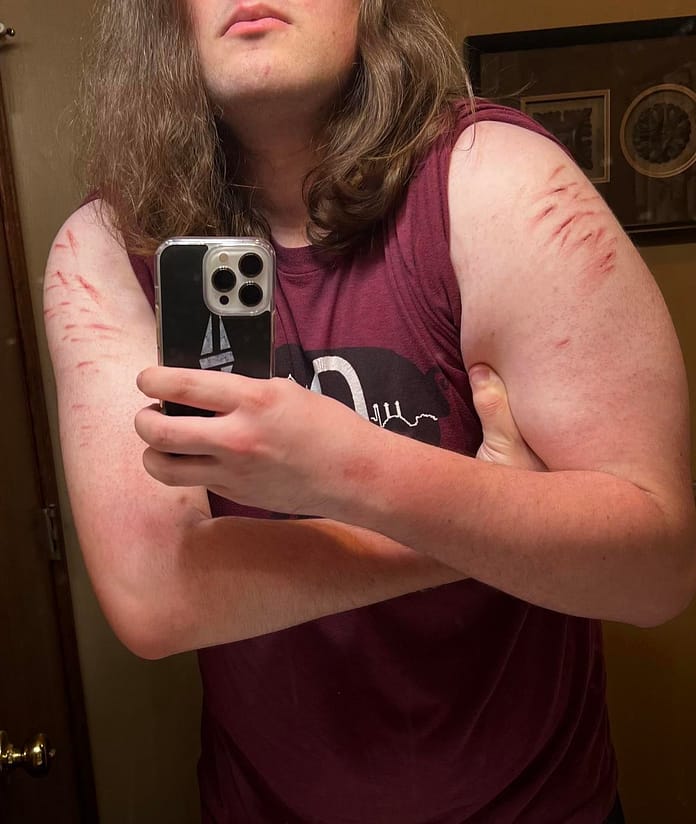 (OC) I’m 17, and this is the first time I’ve been self harm free in years for 30 days.